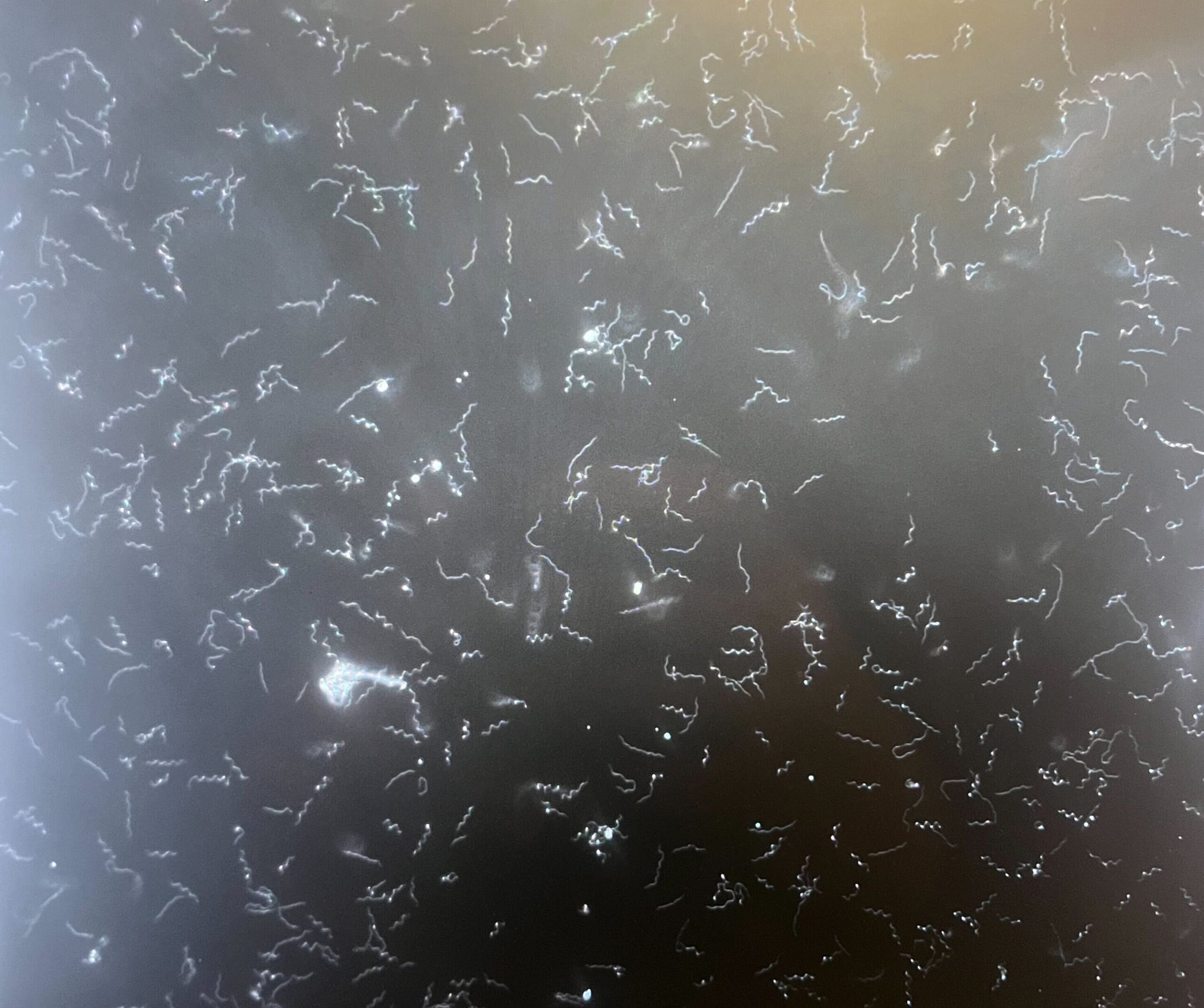 Borrelia burgdorferi, bactérie responsable de la maladie de Lyme, vue au microscope